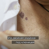 https://e.radikal.host/2025/07/19/067.th.png
